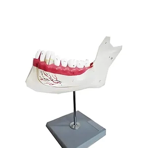 مولاژ آرواره پایینی