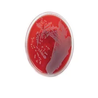 محیط کشت actinomyces agar