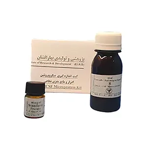 کنترل پروتئین csf