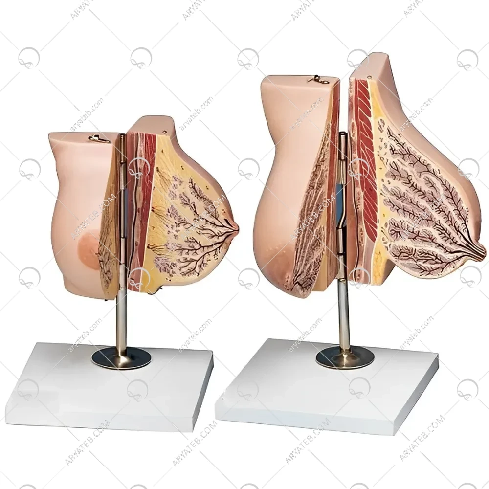 مولاژ غدد پستان