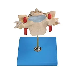 مولاژ مهره گردن با نخاع