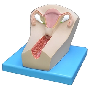 مولاژ آیودی گذاری