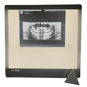 نگاتسکوپ دیجیتال عاج طب مدل CTX-PG-AT