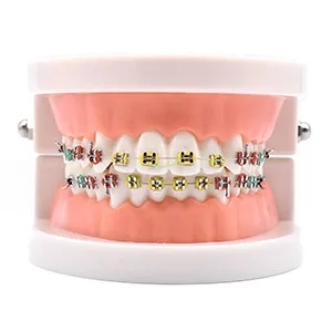 مولاژ دندان مدل ارتودنسی