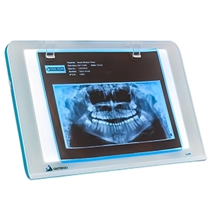 نگاتسکوپ 15 اینچ کریستوفولی