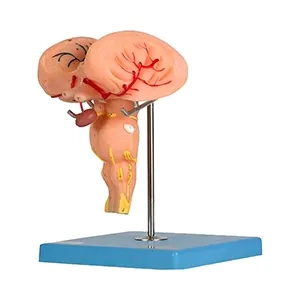 مولاژ ساقه مغز