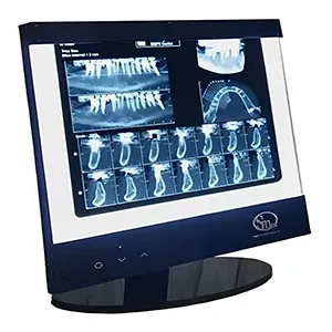 نگاتوسکوپ دندانپزشکی