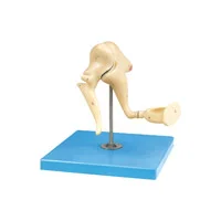 مولاژ استخوانچه گوش