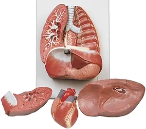 مولاژ قفسه سینه