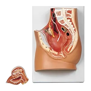 مولاژ لگن خاصره زن