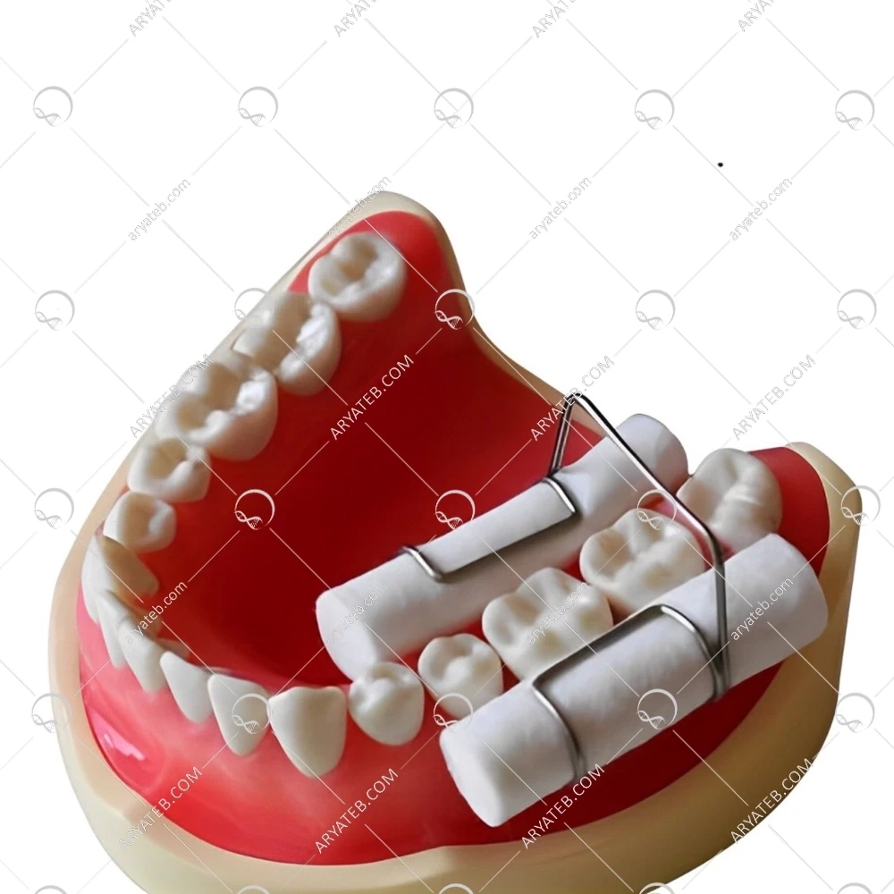 گیره رول پنبه فلزی تکسان