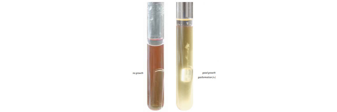 عکس محیط کشت BRYANT BURKEY BROTH WITH RESAZURIN AND LACTATE FOR MICROBIOLOGY