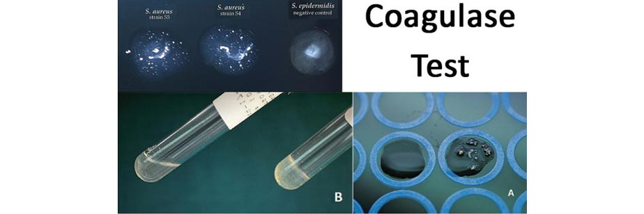 محیط کشت Coagulase Test