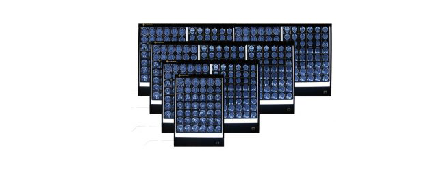 نگاتوسکوپ پزشکی