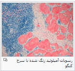 عکس کنگو رد