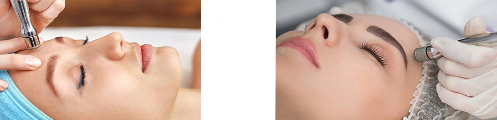 دستگاه میکرودرم ابریژن