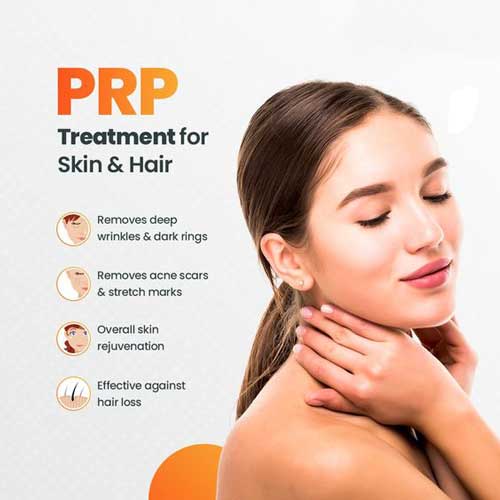 قیمت کیت پی آر پی بی دی