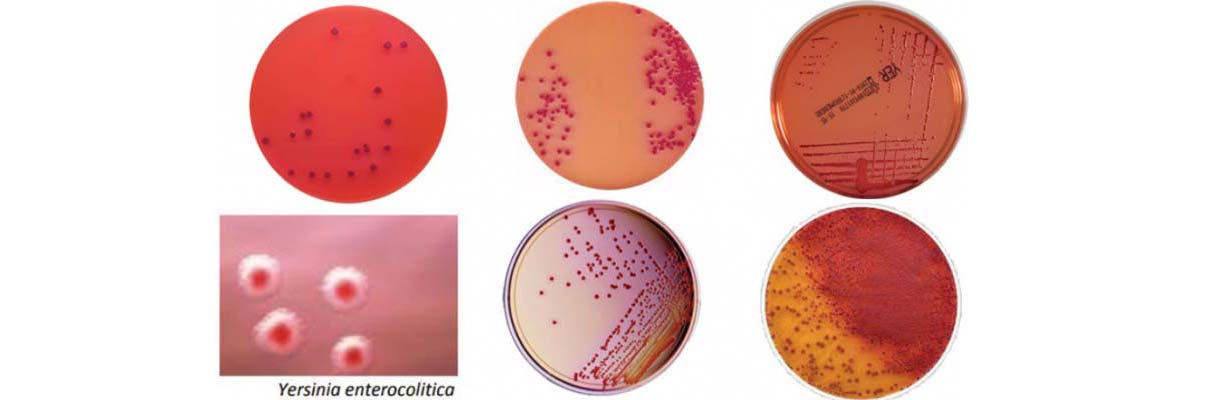 محیط کشت یرسینیا آگار