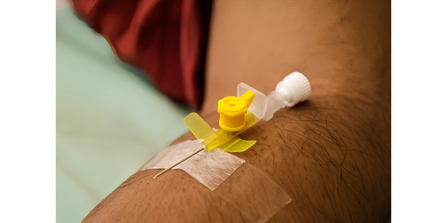 انژیوکت زرد