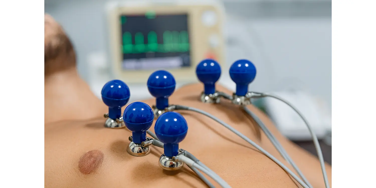 پوار ECG چینی